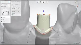 Dental Lab Life Designing an Abutment in 3Shape [upl. by Laband730]