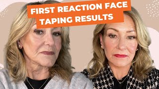 Face Taping Before and After A StepbyStep Guide and is it Right for you [upl. by Neitsirk]