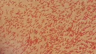 Gram negative bacteria [upl. by Norina]