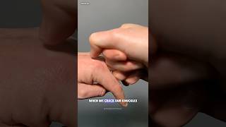 The Truth Behind Finger Cracking Sounds science sciencefacts [upl. by Inej]