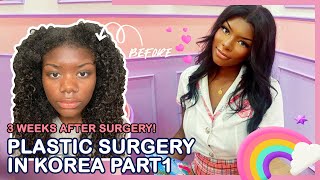 Jaylyns ethnic nose job Rhinoplasty and Facial Contouring Journey  Braun Plastic Surgery Korea [upl. by Pfister]