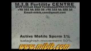 active motile sperm 1 sluggish motile 50 videolow sperm count video [upl. by Archer]