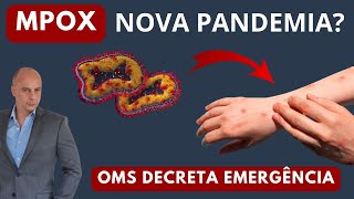 Mpox OMS Decreta EMERGÊNCIA Nova PANDEMIA  Dr Moacir Rosa [upl. by Macur]