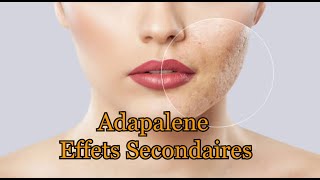 Adapalene Effets secondaires [upl. by Gamin358]