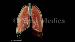 Hemothorax  Lungs [upl. by Drofyar]