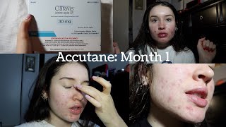 MY ACCUTANE JOURNEY Month 1 Update [upl. by Etnahc]