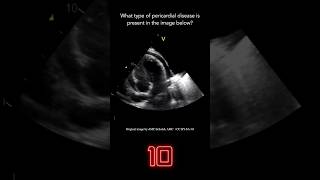 Echocardiography Question 6 [upl. by Imat]