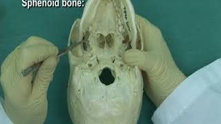 114 Step 13 Sphenoid bone [upl. by Vokaay]