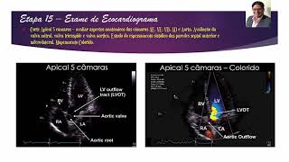 EPISÓDIO 15  Corte Apical 5 Câmaras [upl. by Naillik]