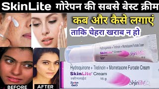 SkinLite Cream Review in Hindi  गोरेपन कि क्रीम  fairness cream  Skin lite Cream Use kaise karen [upl. by Carney]