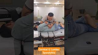 Cervical and Lumbar Spondylitis Treatment in India DrMushtaque 🇮🇳 chiropractor Migren sciatica [upl. by Nivre809]