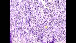 Simple columnar epithelium with goblet cells Duodenum [upl. by Brear]