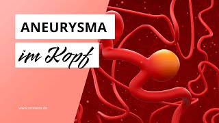 Aneurysma im Kopf Diese Symptome sind Warnzeichen [upl. by Ander]