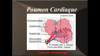 Poumon Cardiaque Oedeme aigu du poumon OAP Physiopathologie de linsuffisance cardiaque gauche [upl. by Tompkins350]