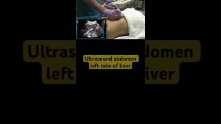 Ultrasound Abdomen left liver lobe [upl. by Ayaros]