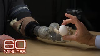 How advancements in prosthetic technology allow feeling control  60 Minutes [upl. by Oakes270]