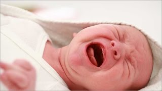 Cranial Osteopathy for Crying New Born Babies [upl. by Losiram]