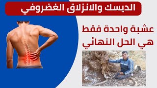 اقوى وصفة في علاج ديسك الظهر و ديسك الرقبة نهائيا الى الابد [upl. by Roid972]