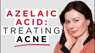 Azelaic Acid 5 Reasons To Use Azelaic Acid In Acne  Dr Sam Bunting [upl. by Anerb]