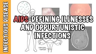 Opportunistic Infections and AIDSdefining illnesses  CD4 cell count malignancy treatment [upl. by Oberon]