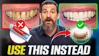 Neuroscientist quotToothpaste Is Damaging Your Teethquot How To Take Care of Your Teeth [upl. by Krysta]