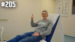 GEBROKEN ELLEBOOG CONTROLE  ENZOKNOL VLOG 205 [upl. by Tolmann]