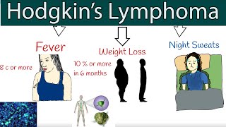 Hodgkins lymphoma Hodgkins disease  Symptoms and treatment How to detect lymphoma [upl. by Cal610]