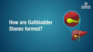 How are Gallbladder Stones formed [upl. by Hoopen854]