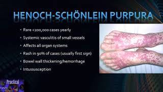 HenochSchönlein Purpura [upl. by Ullund]