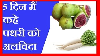 5 दिन मैं कहे पथरी को अलविदा  गुर्दे की पथरी की चमत्कारी दवाई  KIDNEY STONE HOME REMEDIES [upl. by Nahgrom]