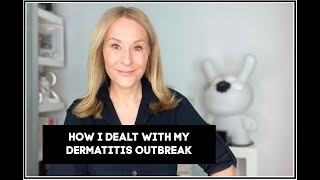 HOW I DEAL WITH MY DERMATITIS [upl. by Neenaj]