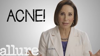 What is Acne and How Do I Get Rid of it Forever  Allure [upl. by Maryanna]