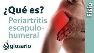 PERIARTRITIS ESCAPULOHUMERAL  ¿Qué es [upl. by Einahpets]