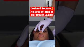 Deviated Septum 👃 Adjustment Helped Her Breath Easier shorts [upl. by Artima]