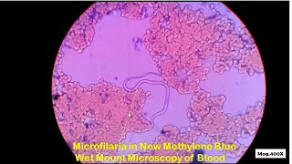 Microfilaria in blood Microscopy [upl. by Duke]