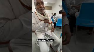 Intention Tremor clinical cerebellum tremor medicine doctor opd [upl. by Mallissa]