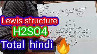 Lewis structure of sulphuric acidbasic chemistry [upl. by Kari]