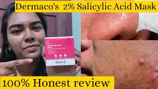 The Derma Co 2 Salicylic Acid Mask Demo amp Review  Face Mask For Acne Marks Pigments Pores [upl. by Ycram]