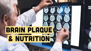 Is Brain Plaque Nutrition Related [upl. by Nniw23]