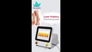 Onychomycosis treatment machine remove foot warts and onychomycosis Triangel Mini60 [upl. by Seppala]