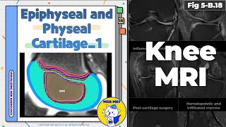 Fig 5B18 Normal Epiphyseal and Physeal Cartilage Part 1 [upl. by Bonnell]