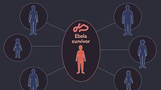 Findings in Survivors of Ebola Virus Disease [upl. by Enttirb863]