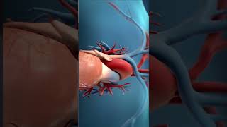 Heart Angioplasty Animated Procedure Explained [upl. by Nodrog437]