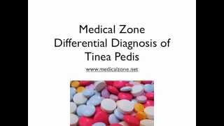 Medical Zone Differential Diagnosis of Tinea Pedis [upl. by Lugar]