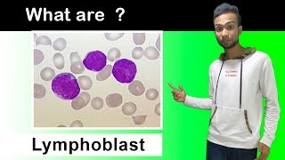 What are Lymphoblast Cells  Complete Overview [upl. by Tisha]