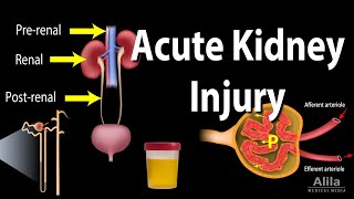 Acute Kidney Injury aka Acute Renal Failure Animation [upl. by Sheply]