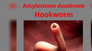 Ancylostoma amp Cutaneous larva migrans dr noha madbouly [upl. by Sugirdor215]