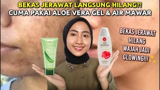 CARA AMPUH MENGHILANGKAN BEKAS JERAWAT HANYA DENGAN ALOE VERA GEL DAN AIR MAWAR wulanhusna [upl. by Soalokin]