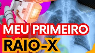 VEJA COMO FUNCIONA UM EXAME DE RAIO X RADIOLOGIA [upl. by Moersch]