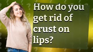 How do you get rid of crust on lips [upl. by Acima]